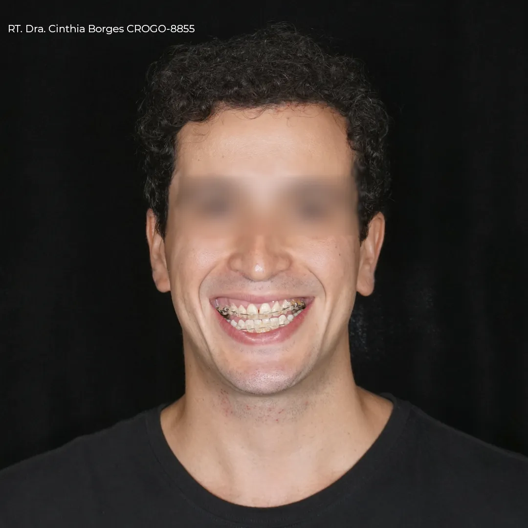 paciente-pre-operatorio02.webp paciente-pre-operatorio02.webp